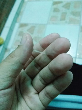 อันนี้มูกหรือ ตกขาวค่ะ 31w