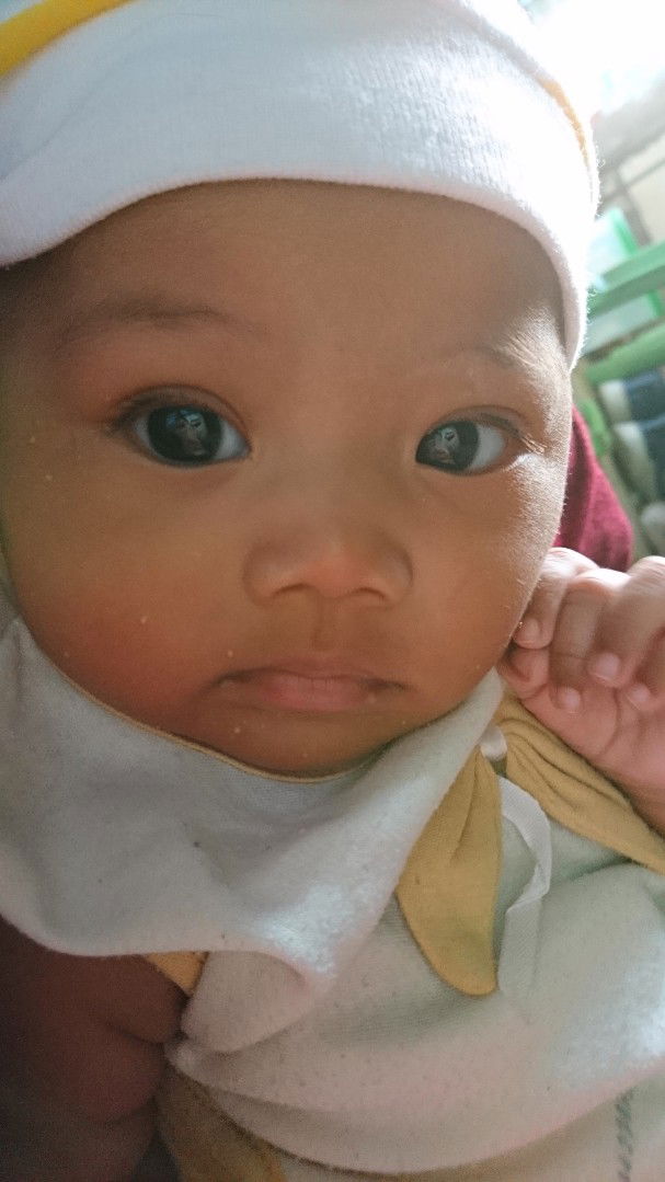 Bun Anak Saya Kenapa Ya?