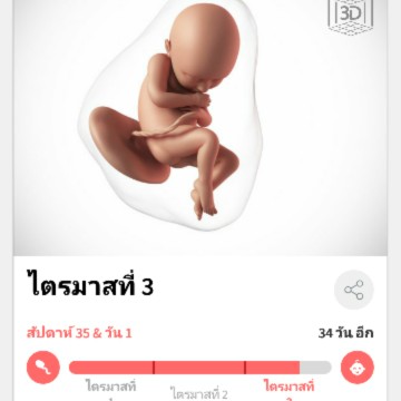 เริ่มเจ็บท้องตั้งแต่เมื่อคืน