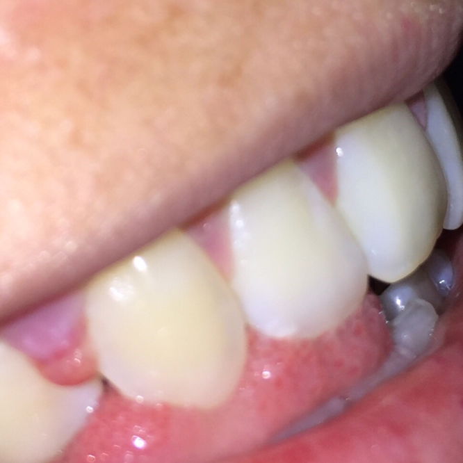 Seperti daging tumbuh.