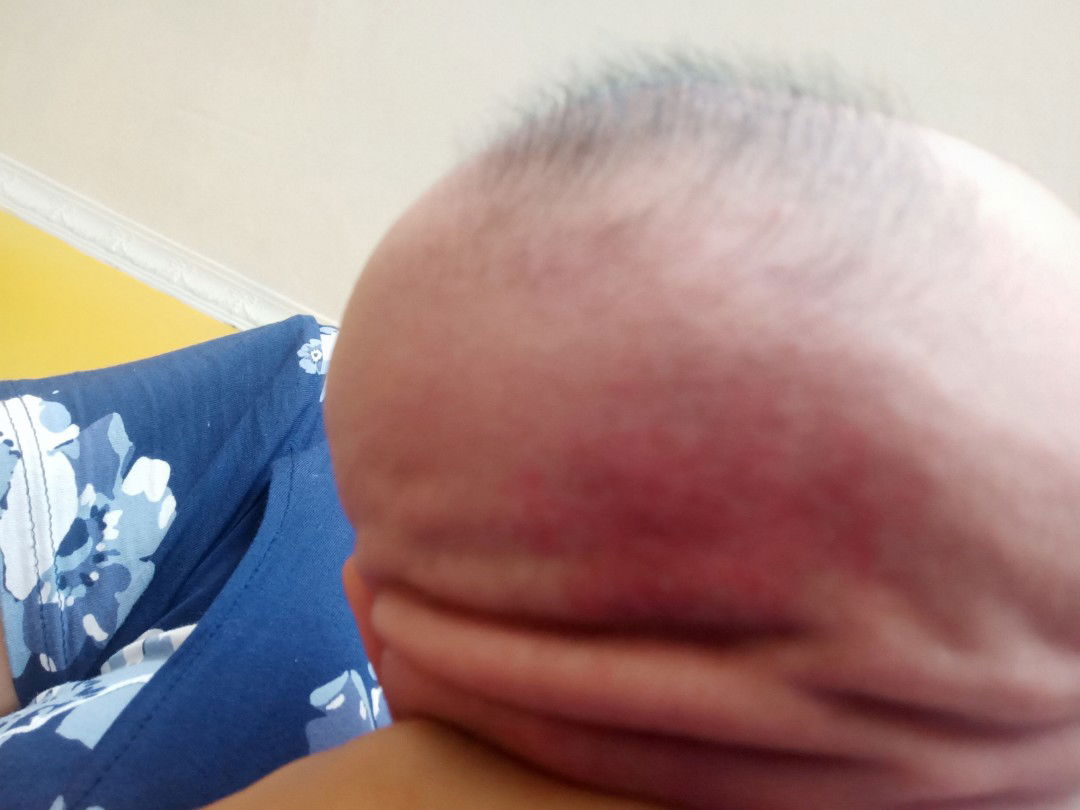 merah di kepala belakang