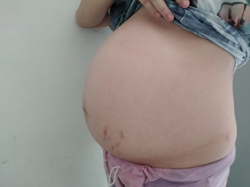 37 Weeks and 6 Days