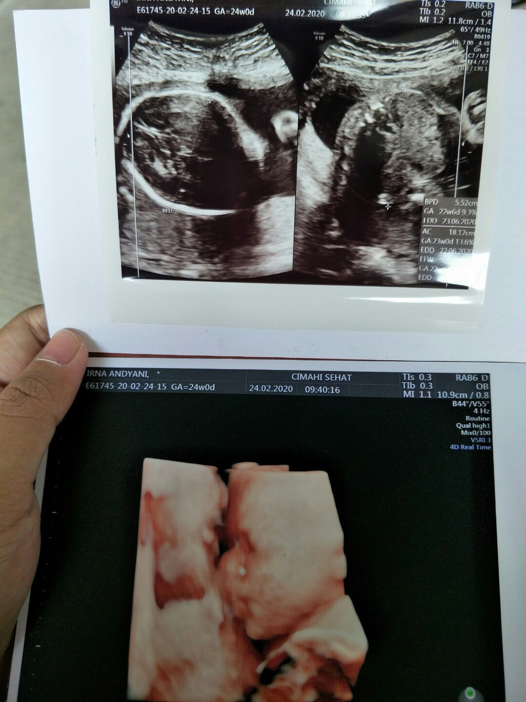 JENIS KELAMIN
