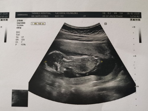 ลูกชายแม่ 15 w+4