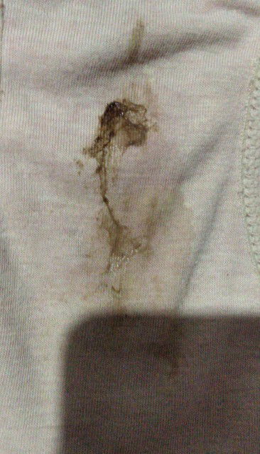 kluar flex usia 32 w 5d