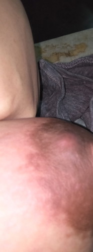 breastfeed