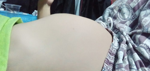 33w5d