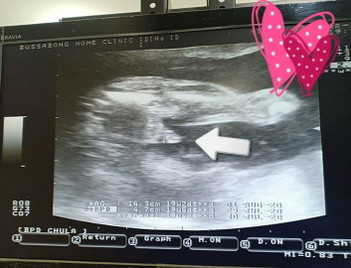 สมใจคุณพ่อเลยครับ