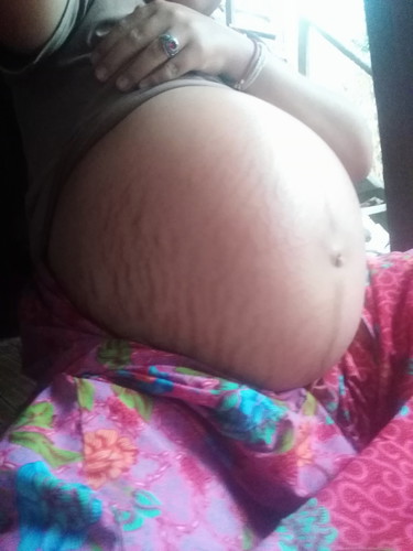 ท้องลาย