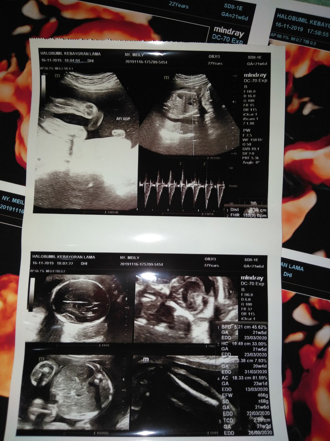 pendapat bunda bunda smart