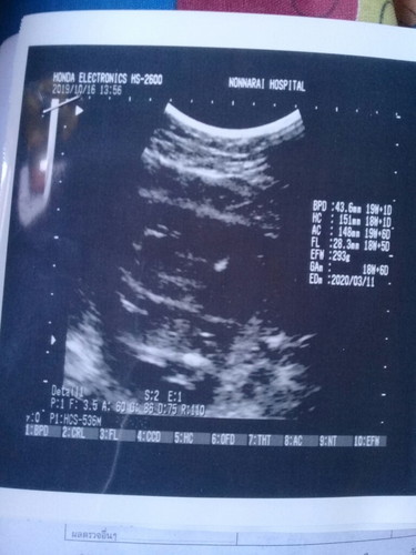 อายุครรภ์5เดือน ควรมีน้ำหนักลูกกี่กรัมถึงจะอยู่ในเกณฑ์