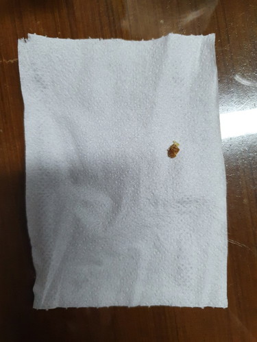 ปกติคุณแม่มีวิธีจัดการขี้หูลูกกันยังไงคะ