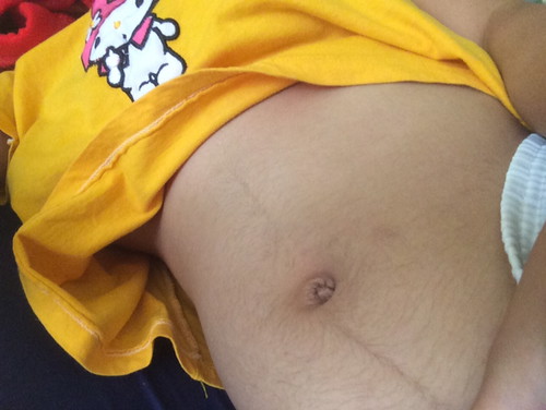 ท้องเล็ก