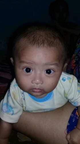 sakit