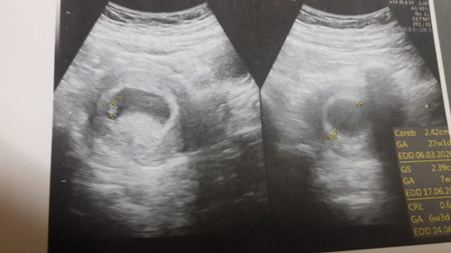 7 week ละจร้า