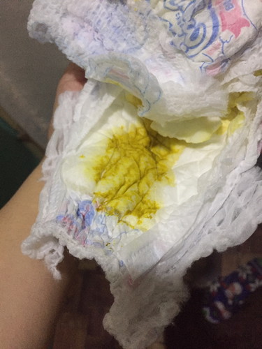 Diarrhea
