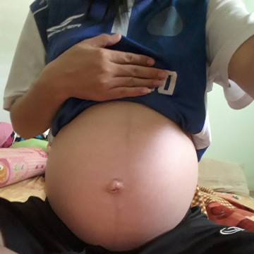 ท้องแบบนี้ชายหรือญิ