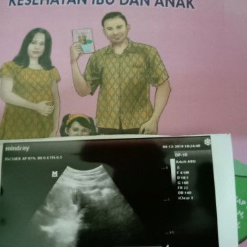 kehamilan 8 Minggu belum kelihatan