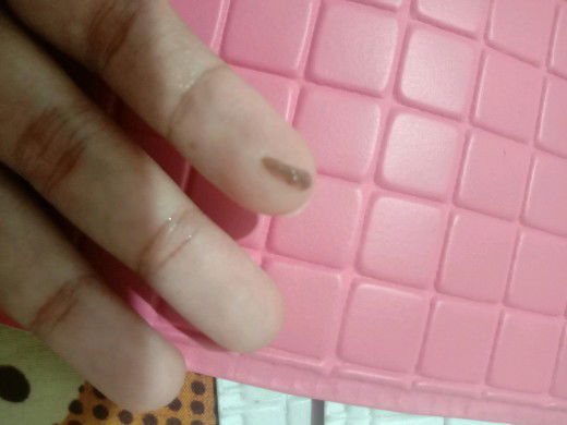 usia kandungan 8 Minggu keluar lendir coklat