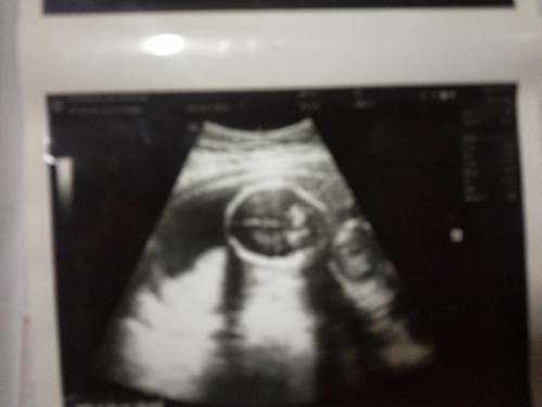ลูกหมู