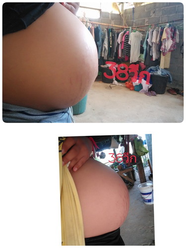 ตั้งท้อง