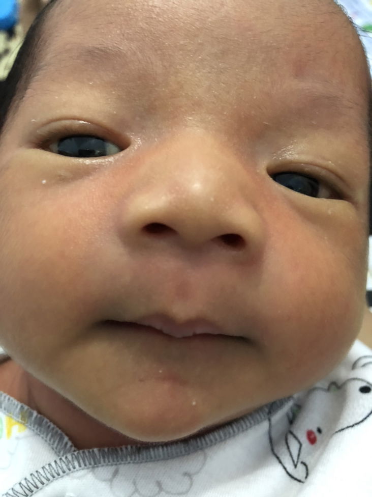 Anak masih kuning di usia 27 hari