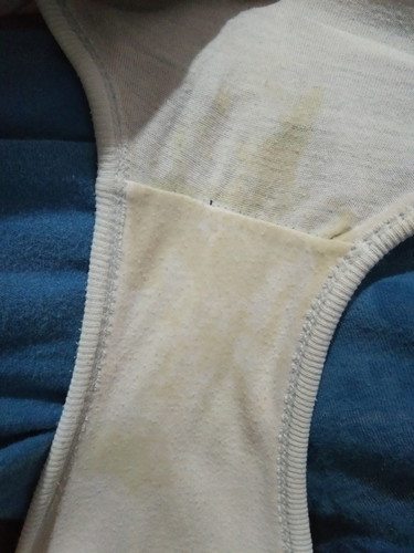 Discharge at 35 weeks