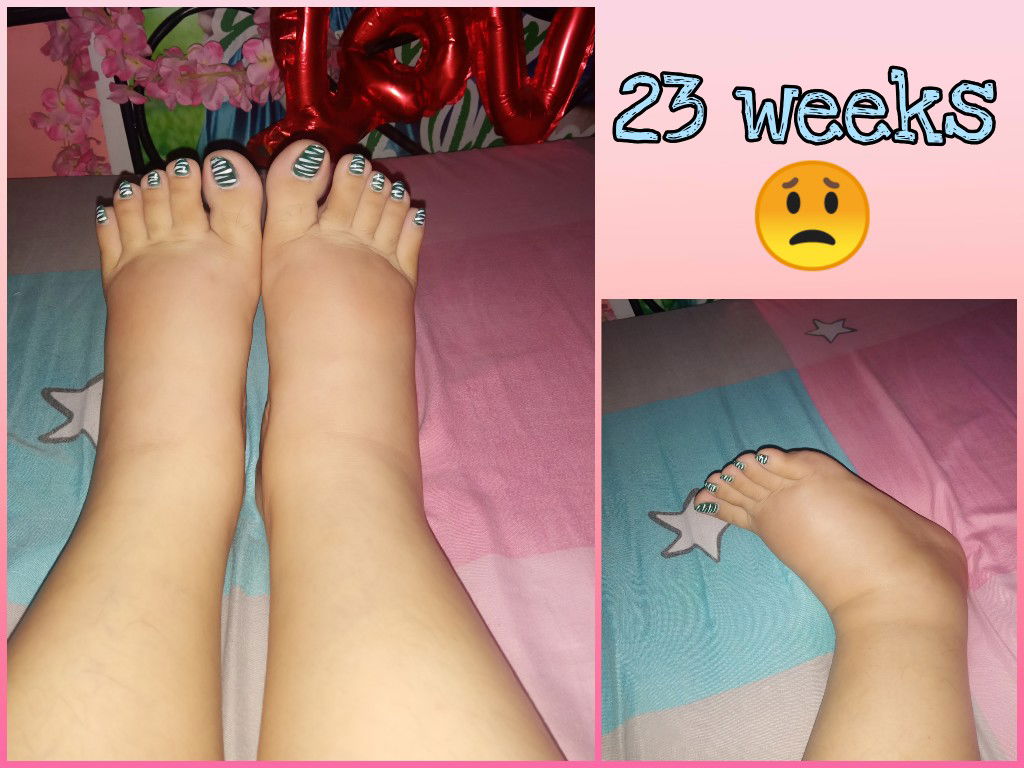 Early Pamamanas/Edema