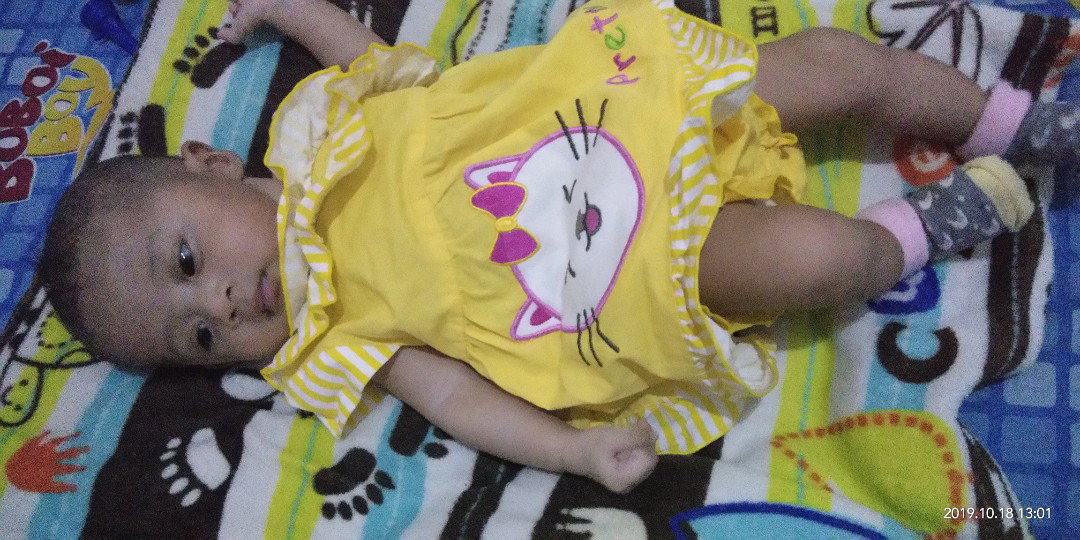 Udah 3 Bulan Lebih Belum Tengkurap