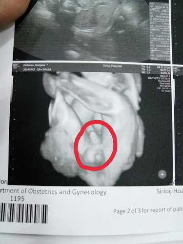 บ้านไหนเห็นเพศชัดเจนกันบ้างค่ะ มาแชร์กันจ้า