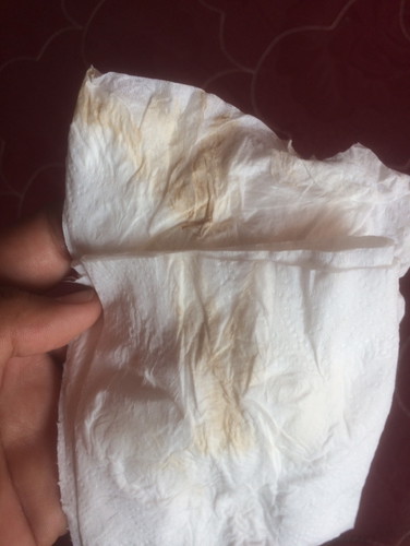 ครรภ์แรกค่ะ