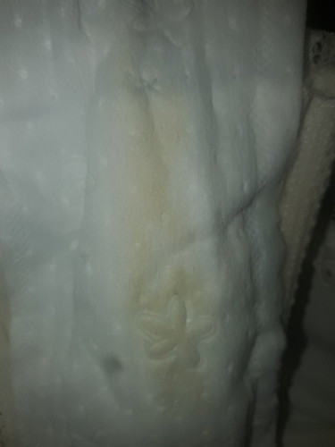 ตกขาวสีเหลืองเข้ม