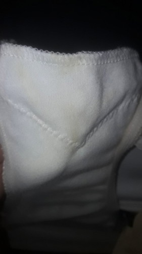 ตกขาวสีเหลือง