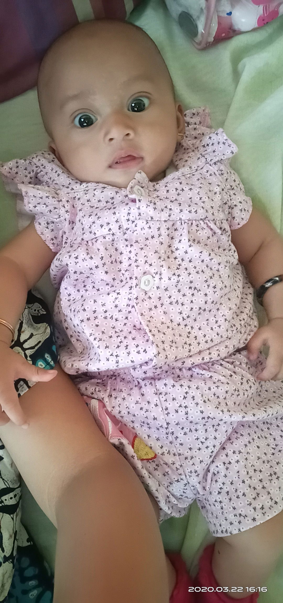 kulit putih seperti panu