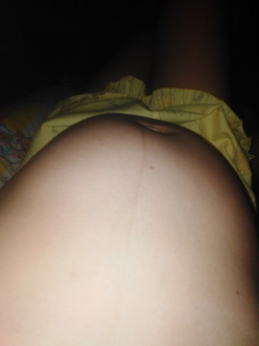 34week?