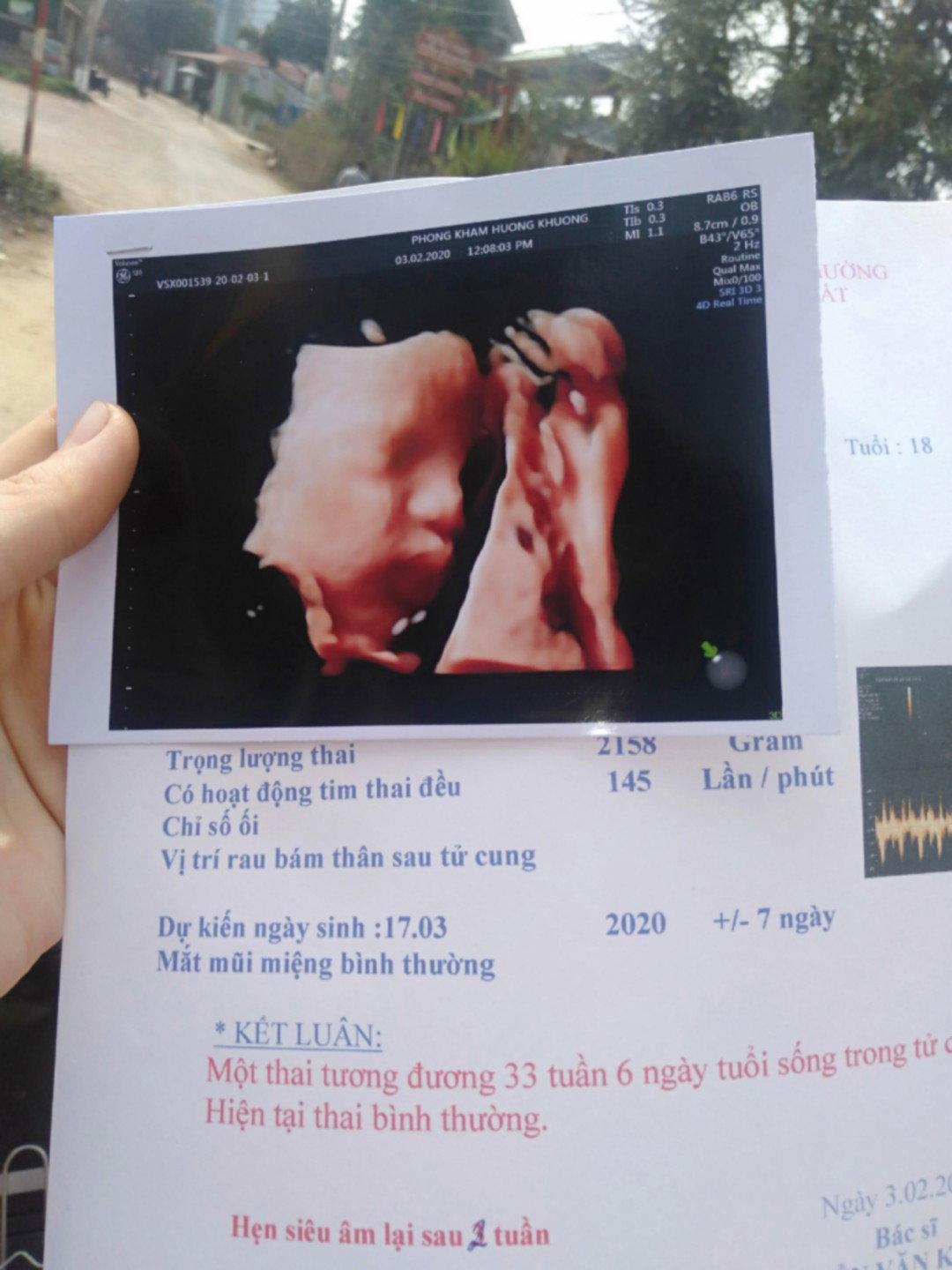 ăn gì để vào con..