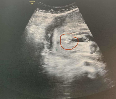 ซาวเพศลูก หญิง ชาย