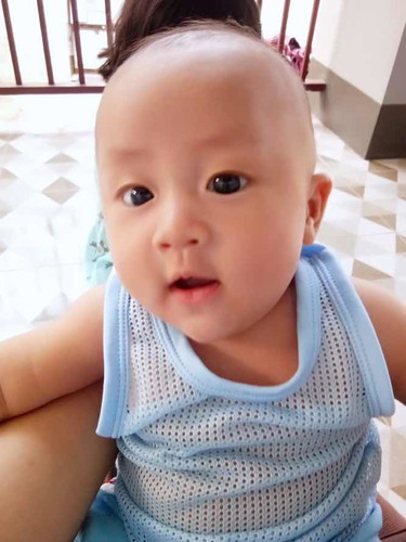 น้ำหนักแรกเกิดน้อย