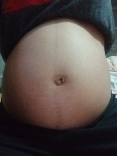 ท้อง25+6week