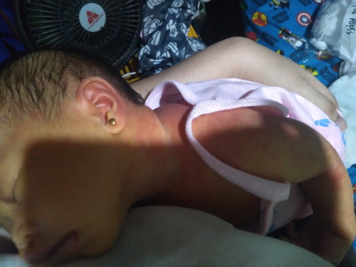 Rashes at white sa mukha