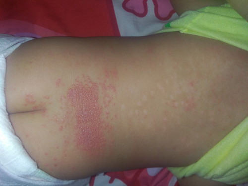 help pls. paano mawala ito ?