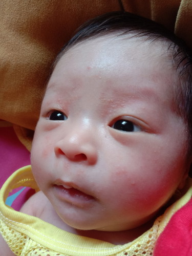 คืออะไร