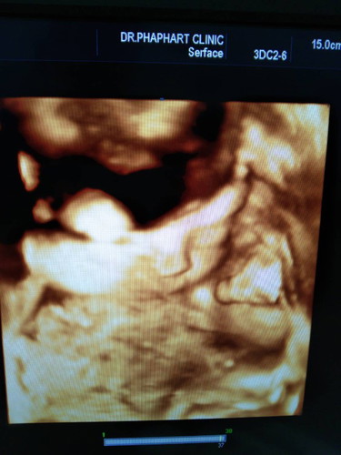 ซาวด์3มิติ ลูกออกมาหน้าเหมือนที่ซาวด์เลยมั้ยคะ??