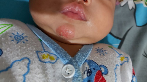 คางของลูก