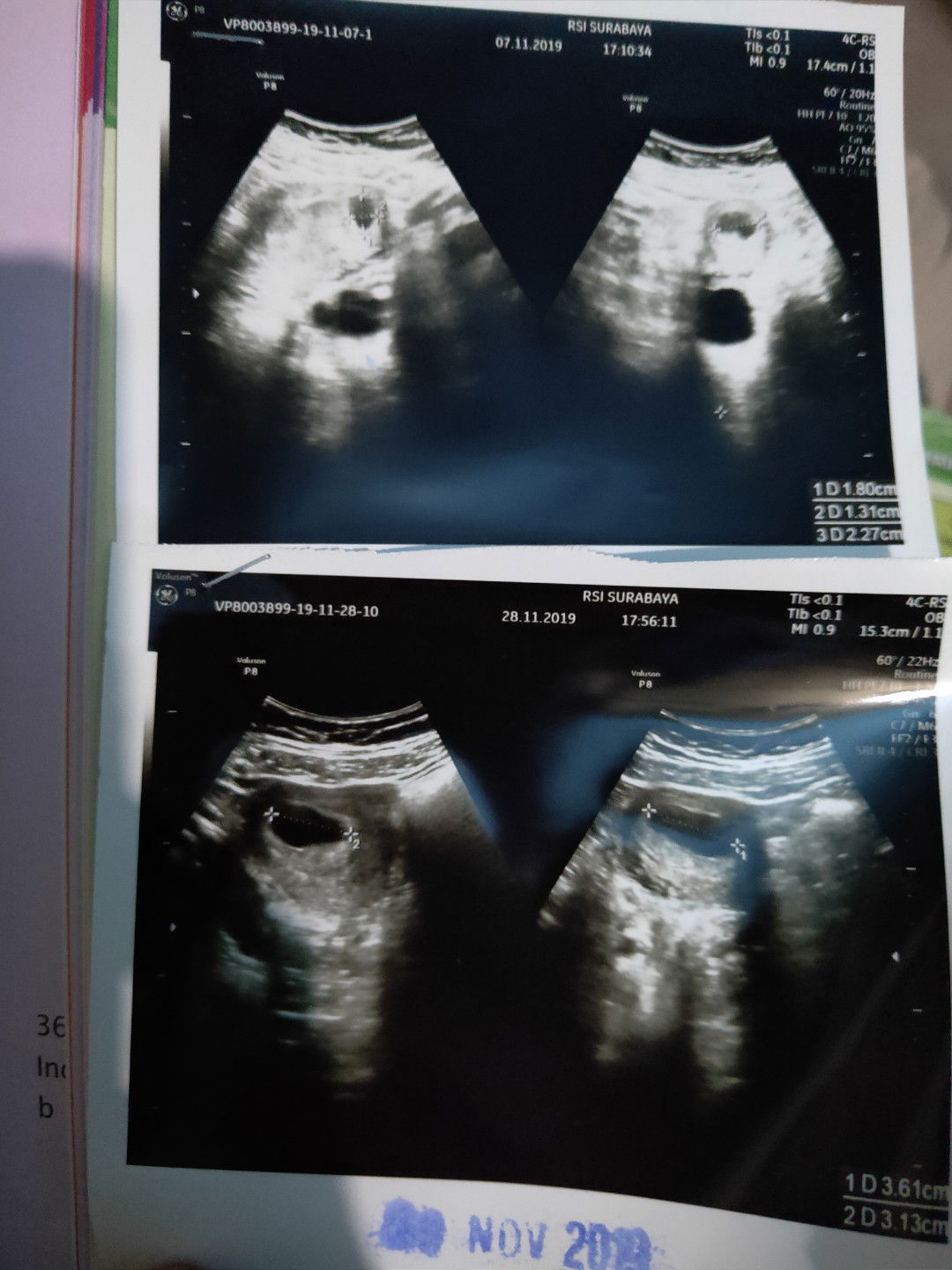 janin belum terlihat