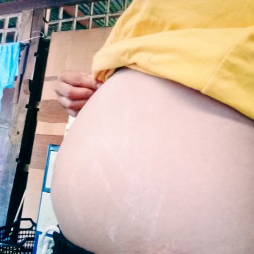 ท้องน้อย