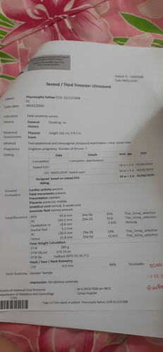 ผลอันตราซาว