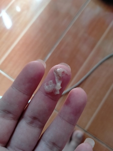 แบบนี้คืออะไรค่ะ