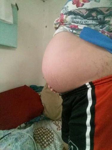 baby bump