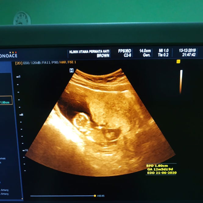 Baby 12 minggu 5 hari